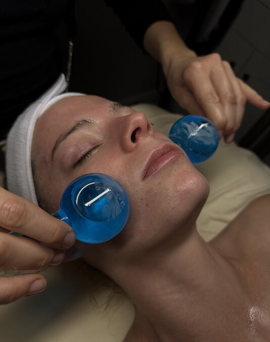 Chemical Peel